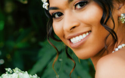 Why Choose Teeth Whitening