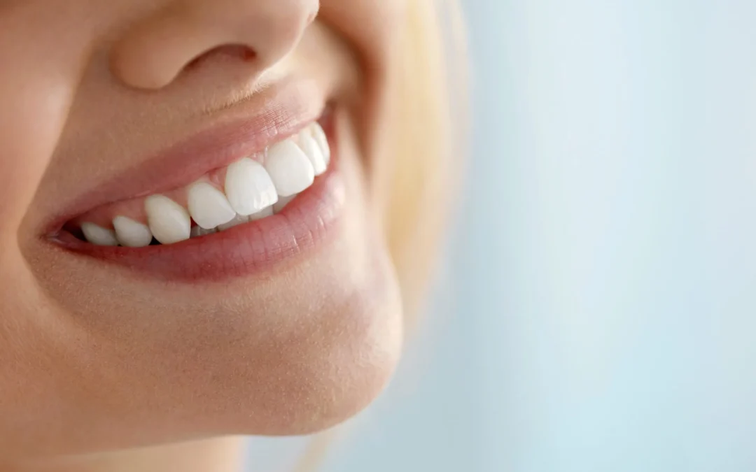 Types of Teeth Whitening and How to Pick One