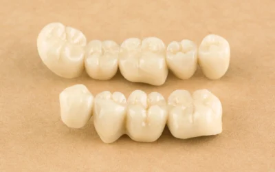 The Benefits of Replacing Missing Teeth Early