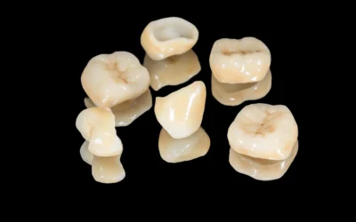 How Do You Know If a Dental Crown Is the Right Choice for Your Tooth?