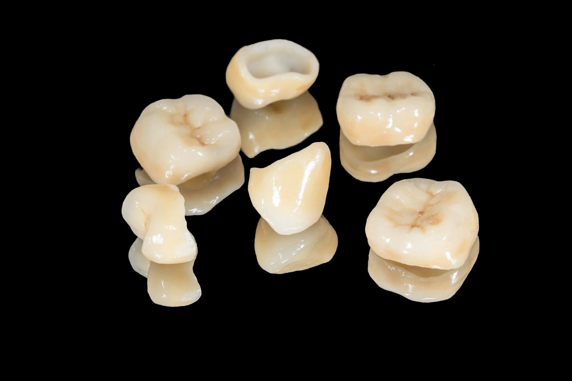 Ceramic dental crowns for front teeth and molars