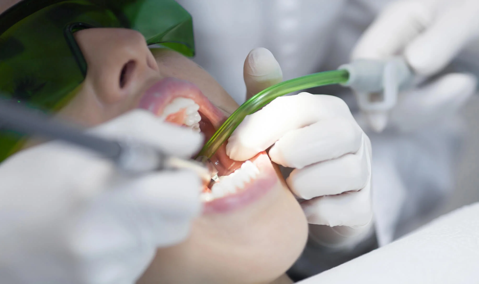 Dental exam and gum care dentist in Kennett