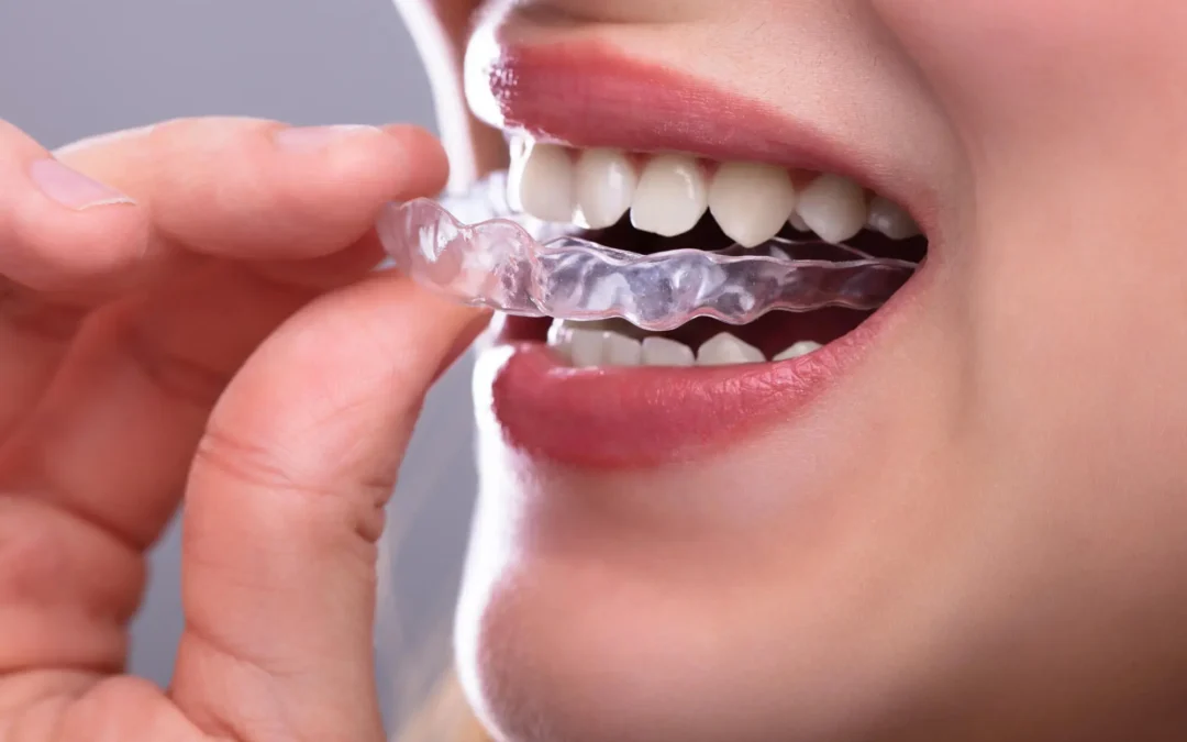 The Harm of Malocclusion: How Misaligned Teeth Affect Your Overall Health