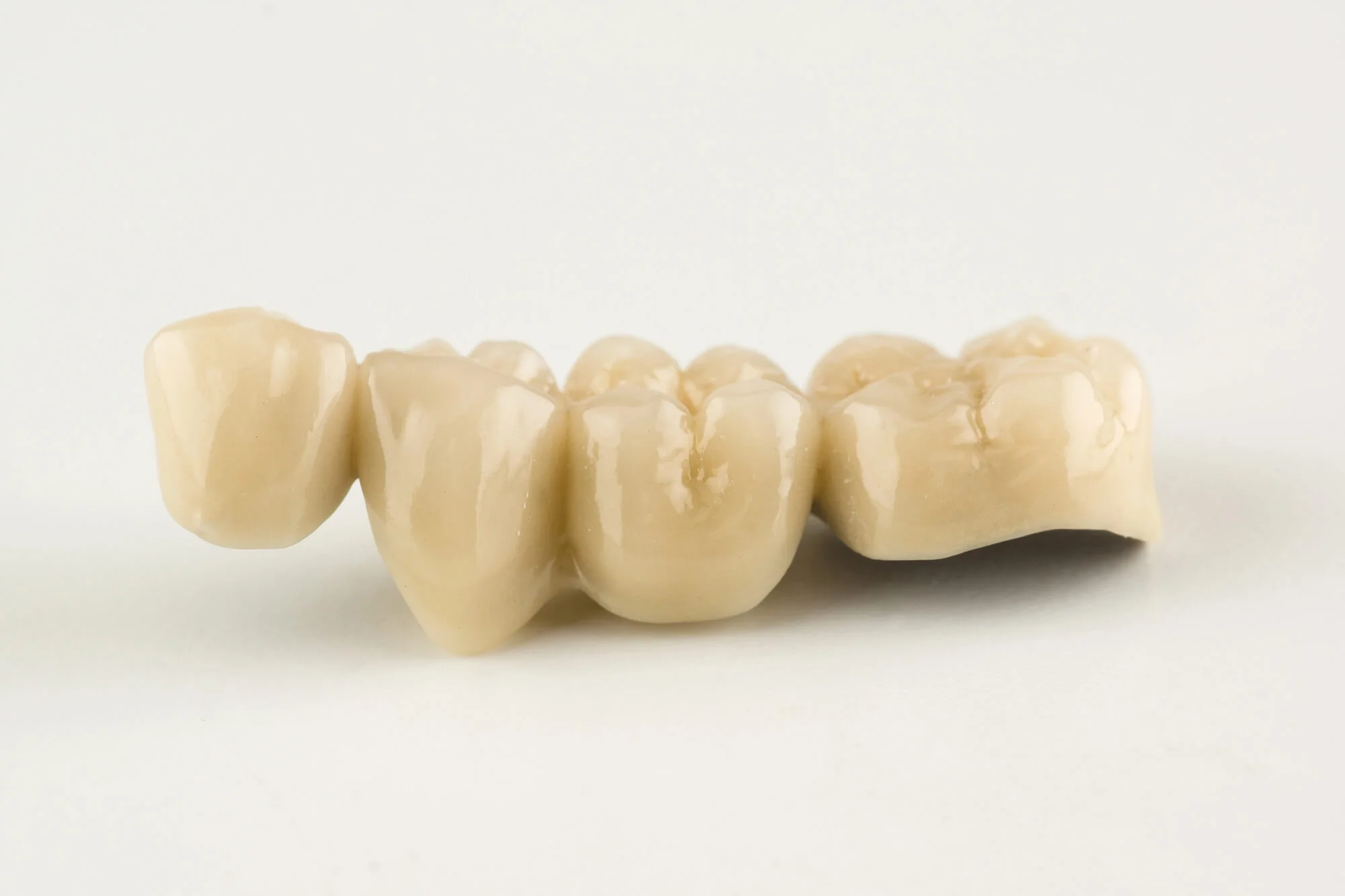 Natural-looking bridge – dental bridges in Kennett Square