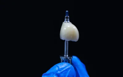 Why Patients Choose Dental Implants Over Dentures Locally