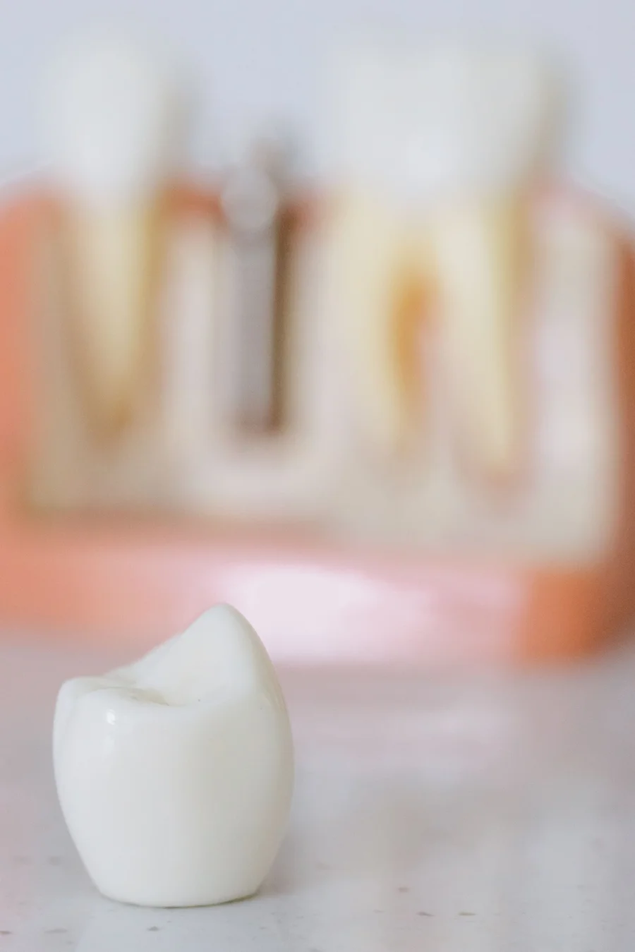 dental implants kennett square crown closeup