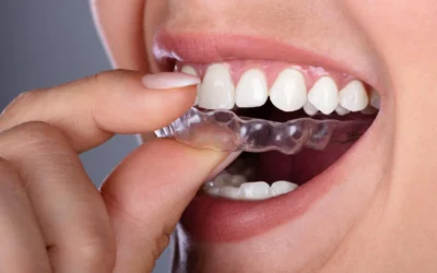 Can You Eat Normally While Straightening Your Teeth?